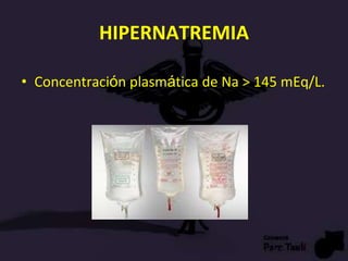 HIPERNATREMIA
• Concentración plasmática de Na > 145 mEq/L.
 