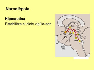Narcolèpsia
Hipocretina
Estabilitza el cicle vigília-son

 