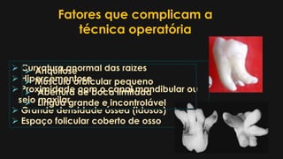 Fatores que complicam a
técnica operatória
 Curvatura anormal das raízes
 Hipercementose
 Proximidade com o canal mandibular ou
seio maxilar
 Grande densidade óssea (idosos)
 Espaço folicular coberto de osso
 Anquilose
 Músculo orbicular pequeno
 Abertura de boca limitada
 Língua grande e incontrolável
 