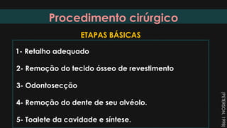 Procedimento cirúrgico
1- Retalho adequado
2- Remoção do tecido ósseo de revestimento
3- Odontosecção
4- Remoção do dente de seu alvéolo.
5- Toalete da cavidade e síntese.
ETAPAS BÁSICAS
(PETERSON,1998)
 