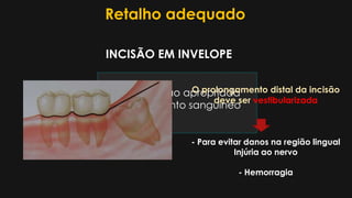 Retalho adequado
 Dimensão apropriada
 Suprimento sanguíneo
INCISÃO EM INVELOPE
- Para evitar danos na região lingual
Injúria ao nervo
- Hemorragia
O prolongamento distal da incisão
deve ser vestibularizada
 