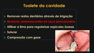 Toalete da cavidade
 Remover restos dentários através de irrigação
 Remover remanescentes do saco pericoronário
 Utilizar a lima para regularizar espículas ósseas
 Suturar
 Compressão com gaze
 