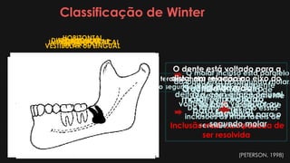 Classificação de Winter
Avalia o posicionamento do terceiro molar em relação
ao longo eixo fisiológico do segundo molar inferior.
IMPACTADO VERTICALMESIOANGULAR
O molar incluso está paralelo
ao longo eixo do segundo molar.
De forma geral, são essas
inclusões as mais fáceis de
serem executadas.
Quando o terceiro
molar está voltado
para a mesial
DISTOANGULAR
O dente está voltado para a
distal em relação ao eixo do
segundo molar
Inclusão mais complicada de
ser resolvida
O dente está totalmente
“deitado”, com a face
oclusal voltada para o
segundo molar
HORIZONTAL
O dente está totalmente
deitado, com a face oclusal
voltada para vestibular ou
lingual.
HORIZONTAL
VESTIBULAR ou LINGUALINVERTIDO
O dente incluso está de
“cabeça para baixo”
(PETERSON, 1998)
 