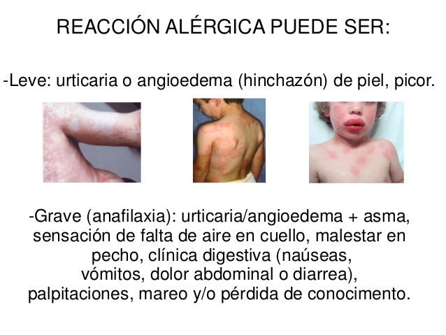 Beneficios Del T De Ortiga Cmo Prepararlo Y Efectos Beneficios Del T De Ortiga Cmo Prepararlo Y Efectos