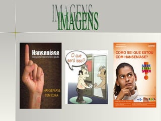 IMAGENS 