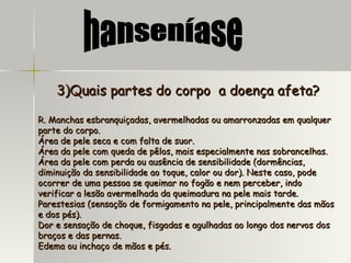 3)Quais partes do corpo  a doença afeta? R. Manchas esbranquiçadas, avermelhadas ou amarronzadas em qualquer parte do corpo. Área de pele seca e com falta de suor. Área da pele com queda de pêlos, mais especialmente nas sobrancelhas. Área da pele com perda ou ausência de sensibilidade (dormências, diminuição da sensibilidade ao toque, calor ou dor). Neste caso, pode ocorrer de uma pessoa se queimar no fogão e nem perceber, indo verificar a lesão avermelhada da queimadura na pele mais tarde. Parestesias (sensação de formigamento na pele, principalmente das mãos e dos pés). Dor e sensação de choque, fisgadas e agulhadas ao longo dos nervos dos braços e das pernas. Edema ou inchaço de mãos e pés. hanseníase 