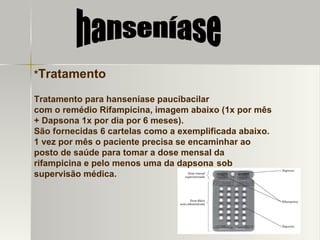 * Tratamento Tratamento para hanseníase paucibacilar com o remédio Rifampicina, imagem abaixo (1x por mês + Dapsona 1x por dia por 6 meses). São fornecidas 6 cartelas como a exemplificada abaixo. 1 vez por mês o paciente precisa se encaminhar ao posto de saúde para tomar a dose mensal da rifampicina e pelo menos uma da dapsona   sob supervisão médica. hanseníase 