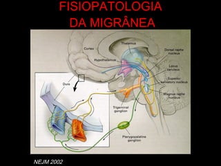 FISIOPATOLOGIA  DA MIGRÂNEA J NEJM 2002 