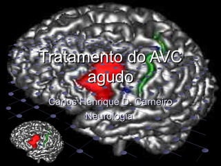 Tratamento do AVC
      agudo
 Carlos Henrique D. Carneiro
         Neurologia
 