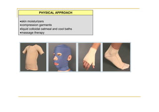 PHYSICAL APPROACH

•skin moisturizers
•compression garments
•liquid colloidal oatmeal and cool baths
•massage therapy
 