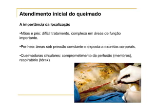 Atendimento inicial do queimado
A importância da localização

•Mãos e pés: difícil tratamento, complexo em áreas de função
importante.

•Períneo: áreas sob pressão constante e exposta a excretas corporais.

•Queimaduras circulares: comprometimento da perfusão (membros),
respiratório (tórax)
 