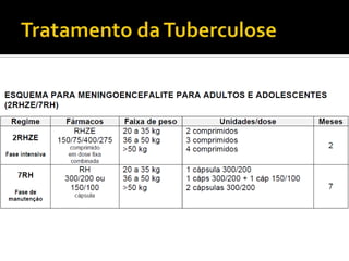 Tratamento da Tuberculose