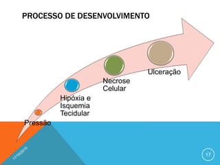 PROCESSO DE DESENVOLVIMENTO
17
Pressão
Hipóxia e
Isquemia
Tecidular
Necrose
Celular
Ulceração
 