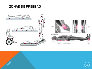 ZONAS DE PRESSÃO
23
 
