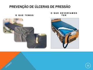 PREVENÇÃO DE ÚLCERAS DE PRESSÃO
O Q U E T E M O S
O Q U E D E V E R Í A M O S
T E R
35
 