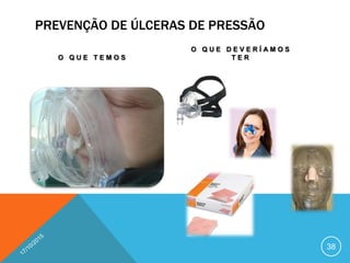 PREVENÇÃO DE ÚLCERAS DE PRESSÃO
O Q U E T E M O S
O Q U E D E V E R Í A M O S
T E R
38
 
