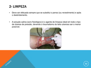 2- LIMPEZA
• Deve ser efetuada sempre que se substitui o penso (ou revestimento) e após
o desbridamento.
• A solução salina (soro fisiológico) é o agente de limpeza ideal em todo o tipo
de úlceras de pressão, devendo o traumatismo do leito ulceroso ser o menor
possível.
50
 