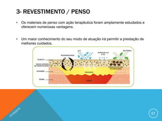 3- REVESTIMENTO / PENSO
• Os materiais de penso com ação terapêutica foram amplamente estudados e
oferecem numerosas vantagens.
• Um maior conhecimento do seu modo de atuação irá permitir a prestação de
melhores cuidados.
51
 