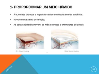 1- PROPORCIONAR UM MEIO HÚMIDO
• A humidade promove a migração celular e o desbridamento autolítico;
• Não aumenta a taxa de infeção;
• As células epiteliais movem- se mais depressa e em maiores distâncias;
53
 