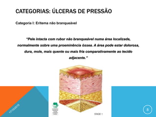 CATEGORIAS: ÚLCERAS DE PRESSÃO
Categoria I: Eritema não branqueável
“Pele intacta com rubor não branqueável numa área localizada,
normalmente sobre uma proeminência óssea. A área pode estar dolorosa,
dura, mole, mais quente ou mais fria comparativamente ao tecido
adjacente.”
8
 