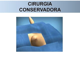 CIRURGIA
CONSERVADORA
 