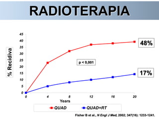 0
5
10
15
20
25
30
35
40
45
0 4 8 12 16 20
%Recidiva
Years
QUAD QUAD+RT
p < 0,001
Fisher B et al., N Engl J Med, 2002; 347(16): 1233-1241.
17%
48%
RADIOTERAPIA
 