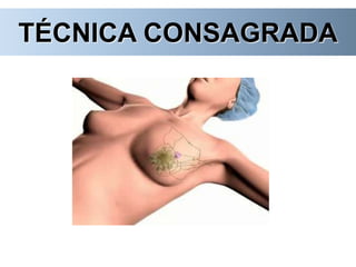 TÉCNICA CONSAGRADA
 