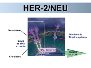 HER-2/NEU
Envio
do sinal
ao núcleo
Núcleo
Atividade da
Tirosina-quinase
Citoplasma
Membrana
Ativação do gene
DIVISÃO
CELULAR
 