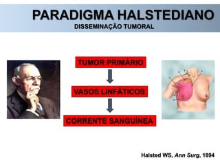 PARADIGMA HALSTEDIANO
DISSEMINAÇÃO TUMORAL
Halsted WS, Ann Surg, 1894
TUMOR PRIMÁRIO
VASOS LINFÁTICOS
CORRENTE SANGUÍNEA
 