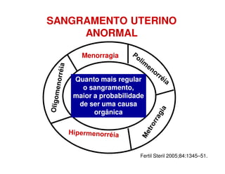 SANGRAMENTO UTERINO
ANORMAL
Menorragia
Quanto mais regular
o sangramento,
maior a probabilidade
de ser uma causa
orgânica
Fertil Steril 2005;84:1345–51.
 