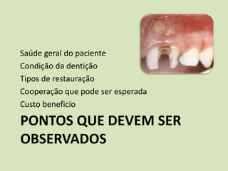 Saúde geral do paciente
Condição da dentição
Tipos de restauração
Cooperação que pode ser esperada
Custo beneficio

PONTOS QUE DEVEM SER
OBSERVADOS
 