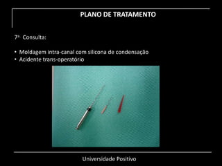 Universidade Positivo
PLANO DE TRATAMENTO
7a. Consulta:
• Moldagem intra-canal com silicona de condensação
• Acidente trans-operatório
 