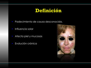 Definición  Padecimiento de causa desconocida. Influencia solar  Afecta piel y mucosas Evolución crónica 