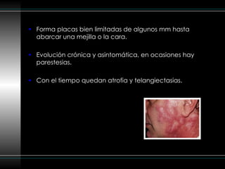 Forma placas bien limitadas de algunos mm hasta abarcar una mejilla o la cara. Evolución crónica y asintomática, en ocasiones hay parestesias. Con el tiempo quedan atrofia y telangiectasias. 