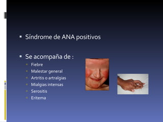 Síndrome de ANA positivos Se acompaña de : Fiebre Malestar general Artritis o artralgias  Mialgias intensas  Serositis Eritema  