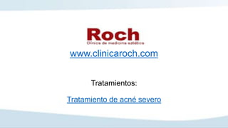 www.clinicaroch.com
Tratamientos:
Tratamiento de acné severo
 