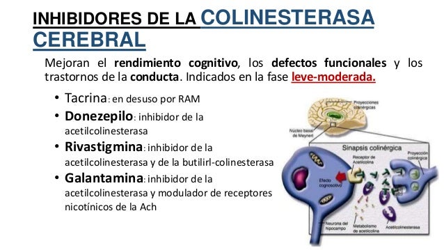 Tratamiento alzheimer Tratamiento alzheimer