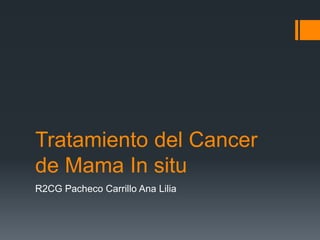 Tratamiento del Cancer
de Mama In situ
R2CG Pacheco Carrillo Ana Lilia
 