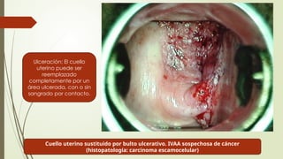 ewfd ewkc ew cjwhecbwjehc weccer invasivo-1.pptx