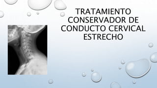 TRATAMIENTO
CONSERVADOR DE
CONDUCTO CERVICAL
ESTRECHO
 