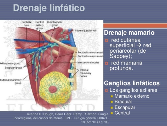 Tratamiento de ca de mama