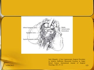 14/08/2013 123
Seiji Ohigashi. A New Laparoscopic Surgical Procedure
to Achieve Sufficient Mesorectal Excision in Upper
Rectal Cancer. International Journal of Surgical
Oncology, 2011. P. 1-4
 