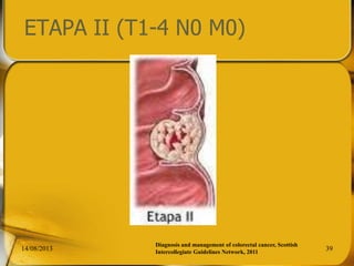 ETAPA II (T1-4 N0 M0)
14/08/2013 39
Diagnosis and management of colorectal cancer, Scottish
Intercollegiate Guidelines Network, 2011
 
