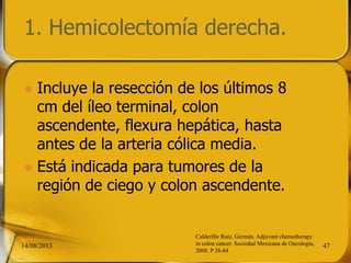 1. Hemicolectomía derecha.
 Incluye la resección de los últimos 8
cm del íleo terminal, colon
ascendente, flexura hepática, hasta
antes de la arteria cólica media.
 Está indicada para tumores de la
región de ciego y colon ascendente.
14/08/2013 47
Calderillo Ruíz, Germán. Adjuvant chemotherapy
in colon cancer. Sociedad Mexicana de Oncología,
2008. P 38-84
 
