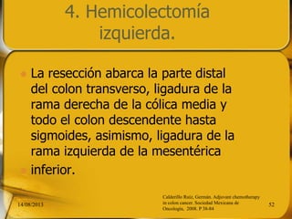 4. Hemicolectomía
izquierda.
 La resección abarca la parte distal
del colon transverso, ligadura de la
rama derecha de la cólica media y
todo el colon descendente hasta
sigmoides, asimismo, ligadura de la
rama izquierda de la mesentérica
 inferior.
14/08/2013 52
Calderillo Ruíz, Germán. Adjuvant chemotherapy
in colon cancer. Sociedad Mexicana de
Oncología, 2008. P 38-84
 
