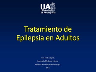 Tratamiento de
Epilepsia en Adultos
Juan José Araya C.
Internado Medicina Interna
Módulo Neurología-Neurocirugía
2016
 