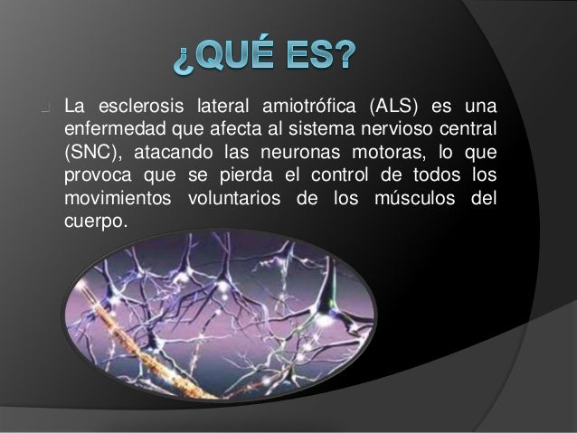 Tratamiento de esclerosis lateral amiotrófica