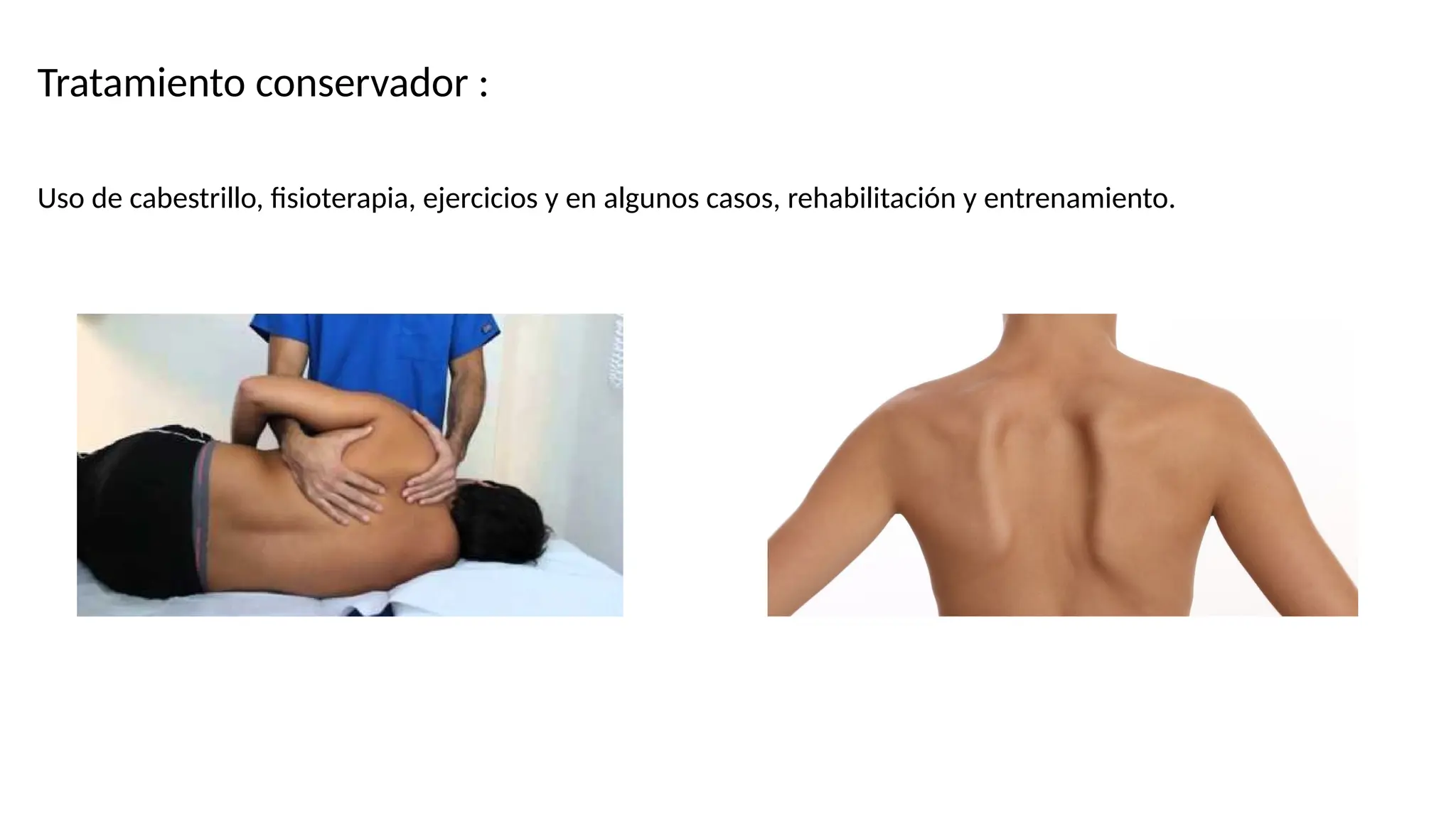 Fracturas de omoplato (escapula) y sus complicaciones | PPTX | Death