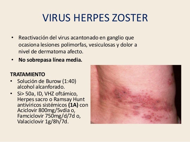 Actualizacion En El Tratamiento De Las Infecciones De La Piel Y Parte