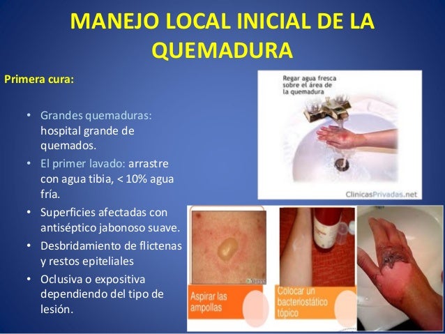 Tratamiento de las quemaduras , profilaxis y tratamiento